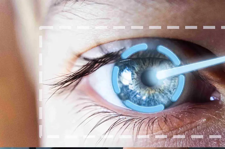 fakta lasik